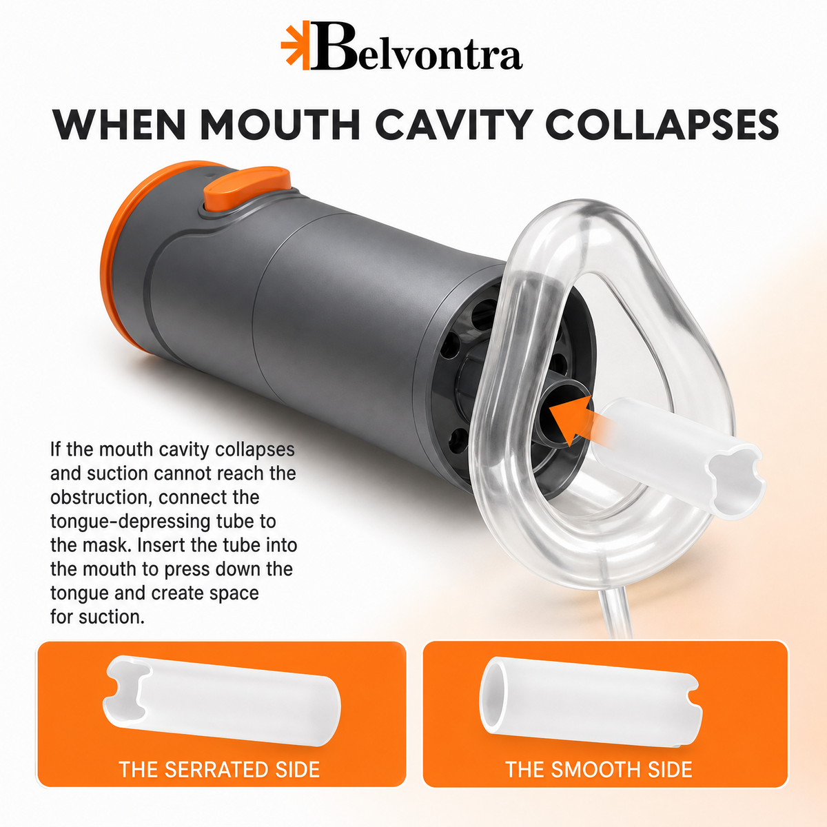 Belvontra™ Anti-choking rescue device
