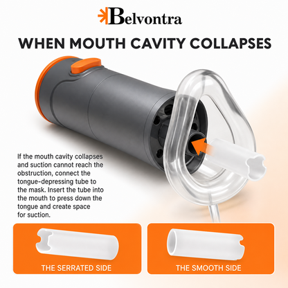 Belvontra™ Anti-choking rescue device